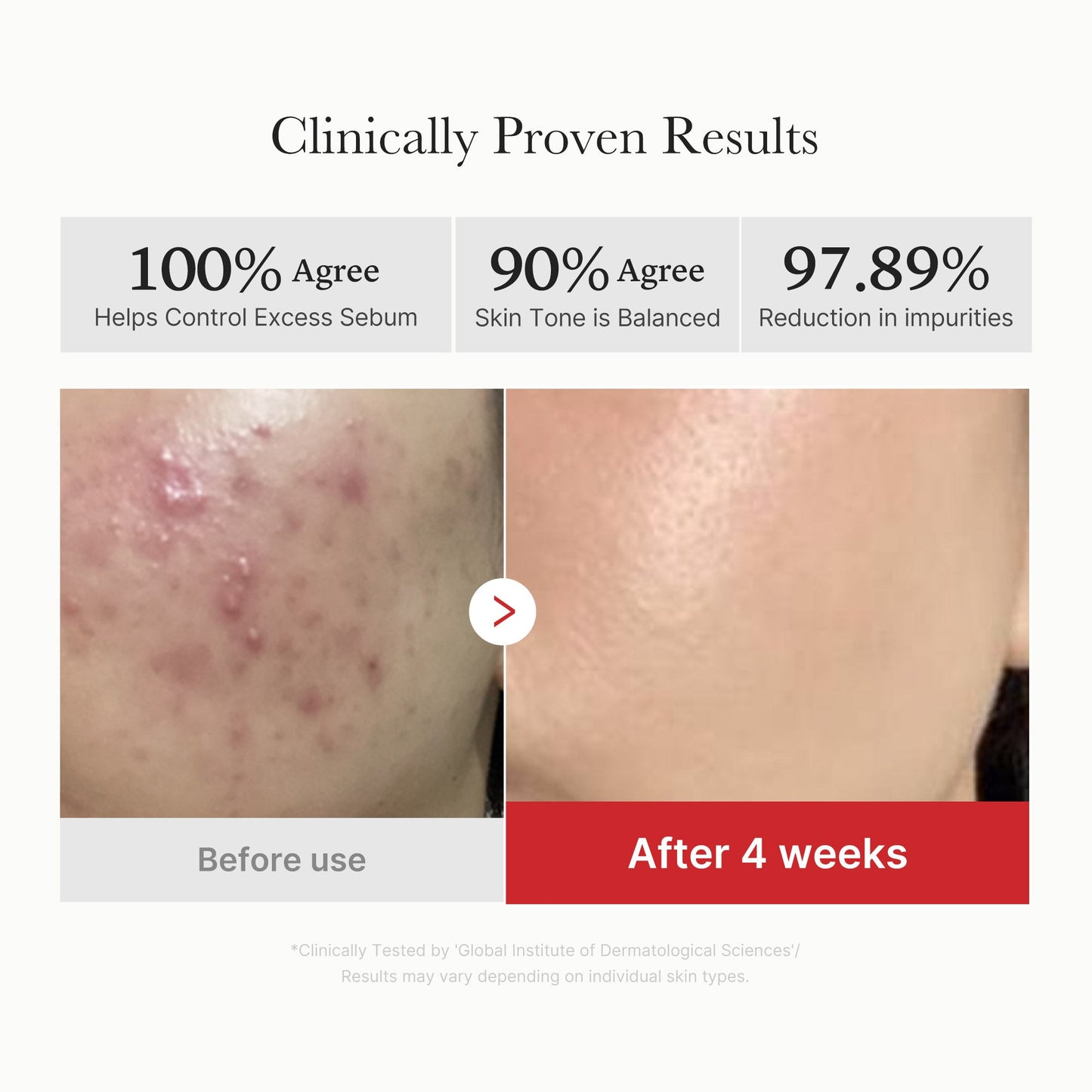 Red Succinic Acid Panthenol Pads