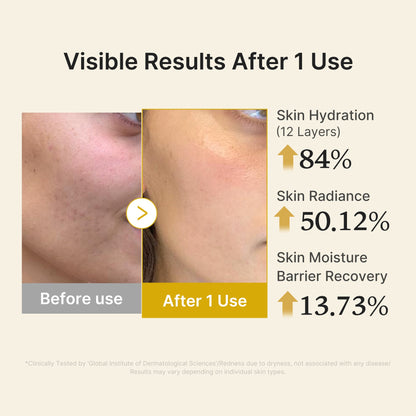 Kojic Acid Turmeric Vitamin Gold Jelly Mist Serum