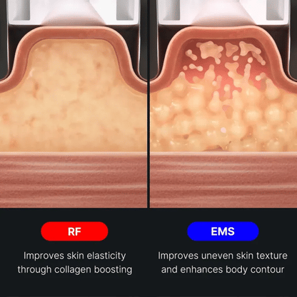 AGE-R Contour Body Shot